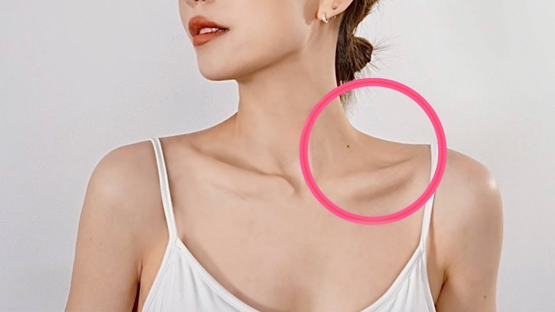 Ốm nhưng không có xương quai xanh Gallery 1