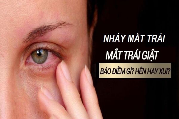 Giật Mắt Trái Nam Là Điềm Gì? Gallery 2