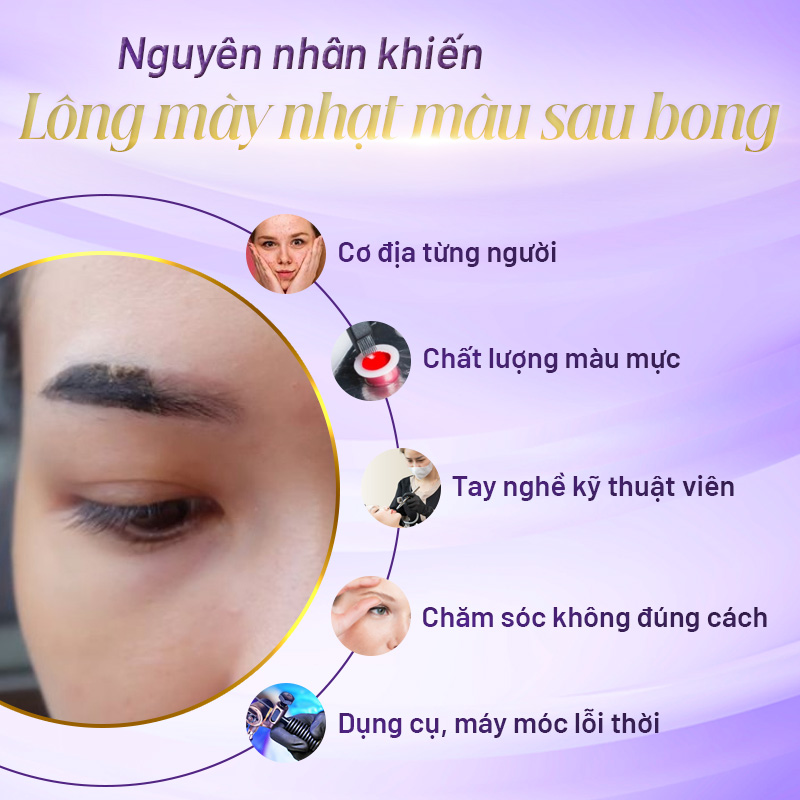 Lông Mày Sau Khi Bong Nhạt Màu: Nguyên Nhân Và Cách Khắc Phục Gallery 1