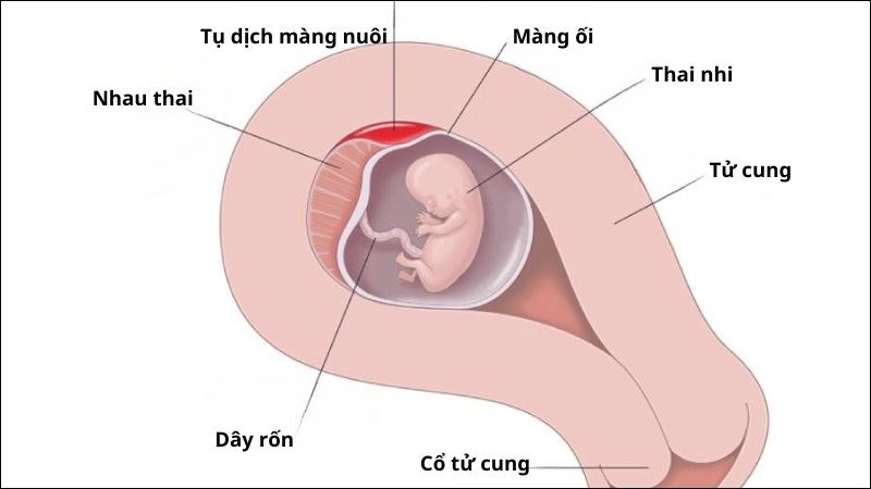 Nguyên nhân màng nuôi mỏng