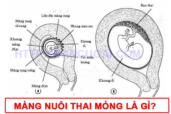 Nguyên nhân màng nuôi mỏng Gallery 2