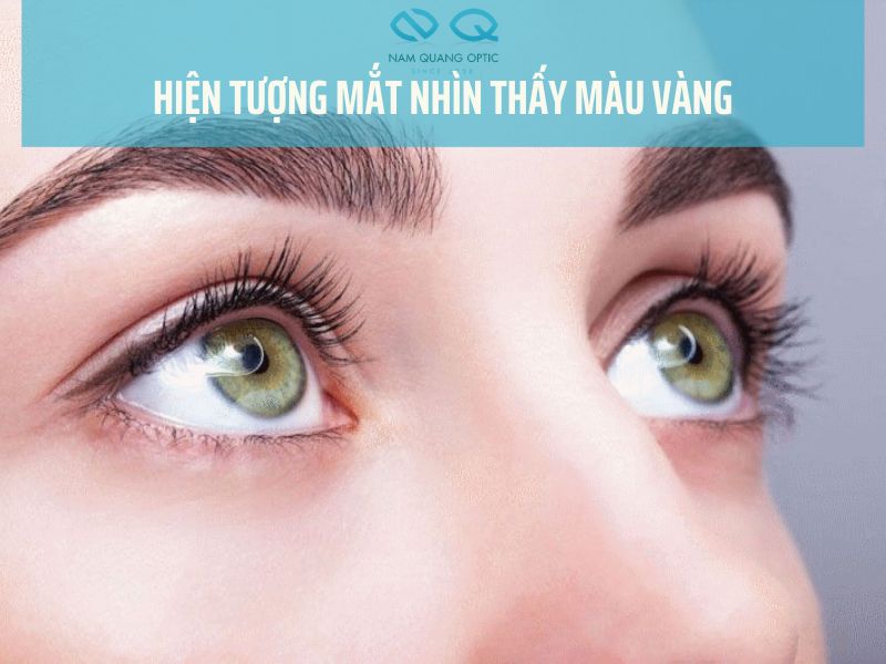 Mắt Nhìn Thấy Màu Vàng: Nguyên Nhân Và Cách Xử Lý Gallery 1