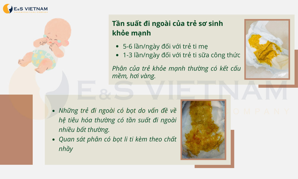 Phân trẻ có bọt: Nguyên nhân và cách xử lý Gallery 1