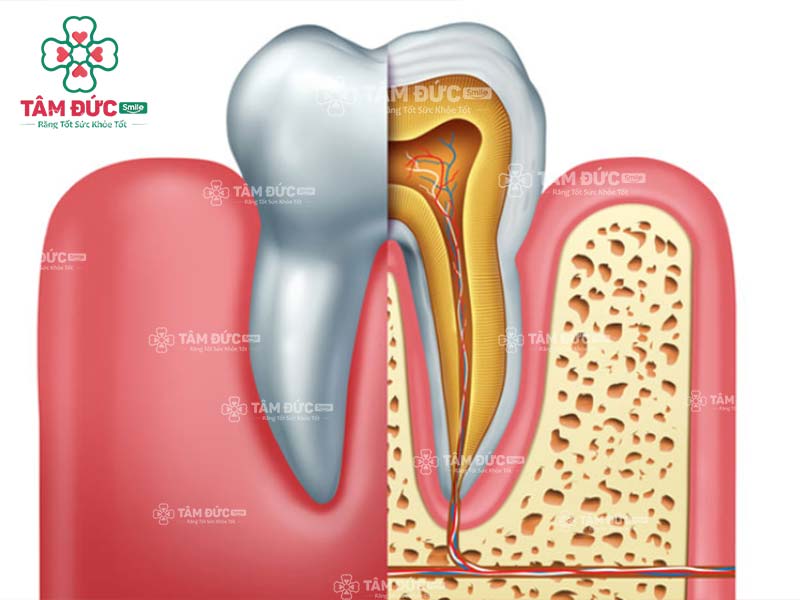 Răng cối bị sâu: Nguyên nhân, triệu chứng và cách điều trị Gallery 1