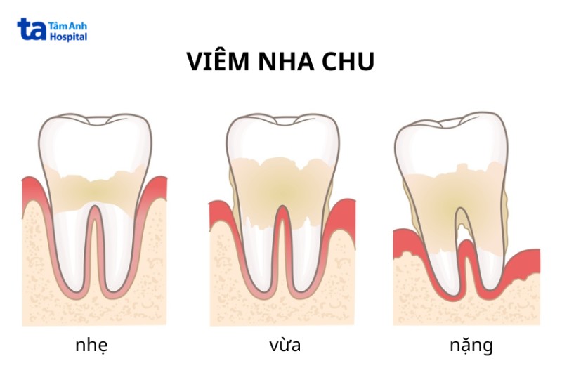 Răng Anh Nỏ Về Gallery 1