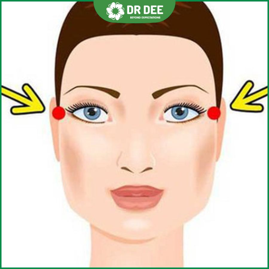 Thái Dương Bị Hóp: Nguyên Nhân, Triệu Chứng Và Cách Điều Trị Gallery 1
