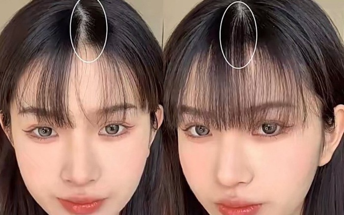 Tóc mái bị vểnh: Nguyên nhân và cách khắc phục hiệu quả Gallery 1