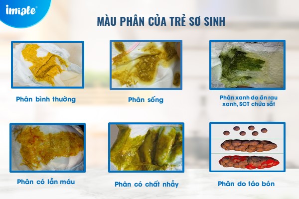 Trẻ Đi Ngoài Màu Bã Trầu: Nguyên Nhân và Cách Xử Lý Gallery 1