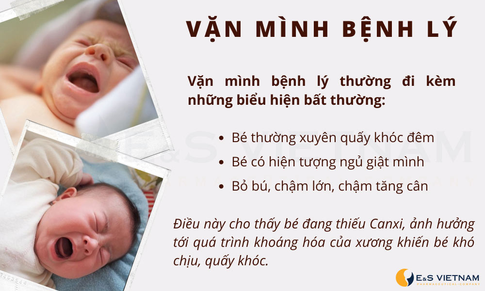 Trẻ Hay Vặn Mình Khi Ngủ: Nguyên Nhân và Cách Khắc Phục Gallery 1