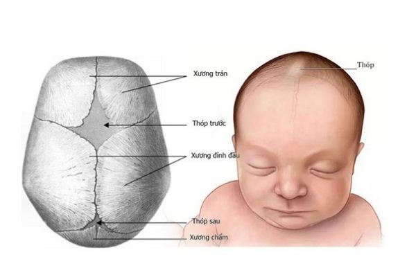 Trẻ sinh ra thóp đã đầy: Nguyên nhân và cách xử trí Gallery 1