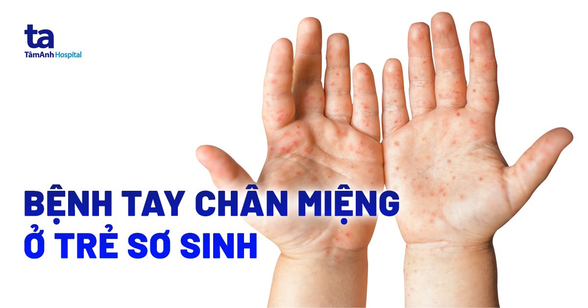 Trẻ sơ sinh khua tay chân nhiều: Nguyên nhân và cách xử lý Gallery 1