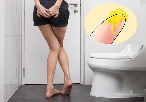 Trẻ xì hơi ra nước màu vàng: Nguyên nhân và cách xử lý Gallery 1