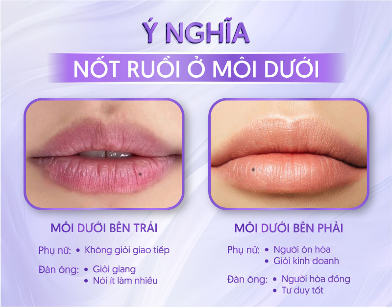 Mụn Ruồi Dưới Môi: Ý Nghĩa, Nguyên Nhân và Cách Xử Lý Gallery 2