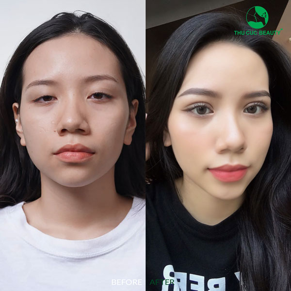Nhấn Mí Thu Cúc: Phương Pháp Làm Đẹp Mắt An Toàn và Hiệu Quả