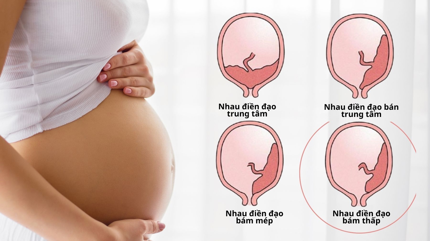 Nhau bám thấp thường tới tuần bảo nhiều thì hết