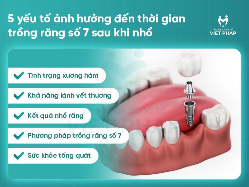 Nhổ răng số 7 bao lâu thì lành?