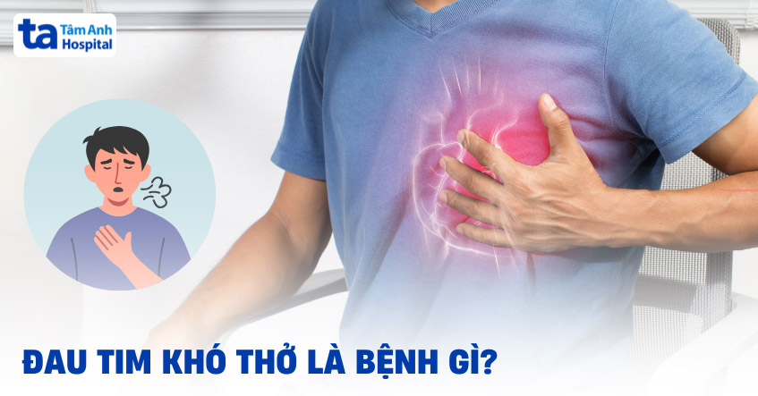 Nhói Tim Khó Thở: Nguyên Nhân, Triệu Chứng Và Cách Xử Trí