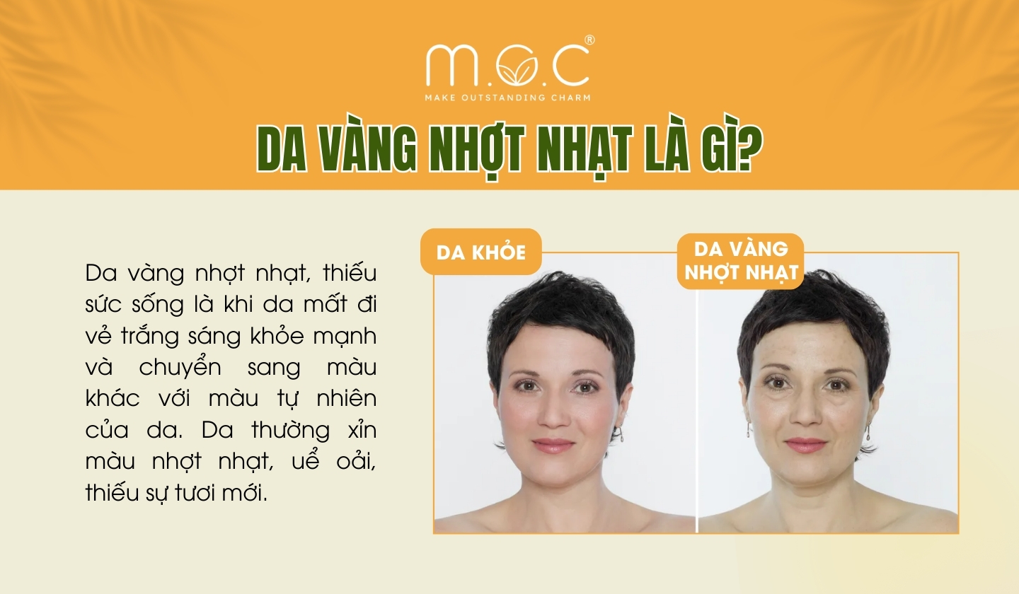 Nhột Nhạt Là Gì?