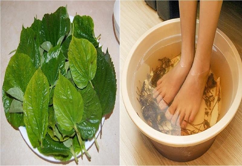Bó Lá Gãy Xương Ở Bắc Giang Gallery 1