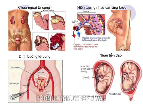 Có thai ngoài tử cung thử que có lên không? Gallery 2
