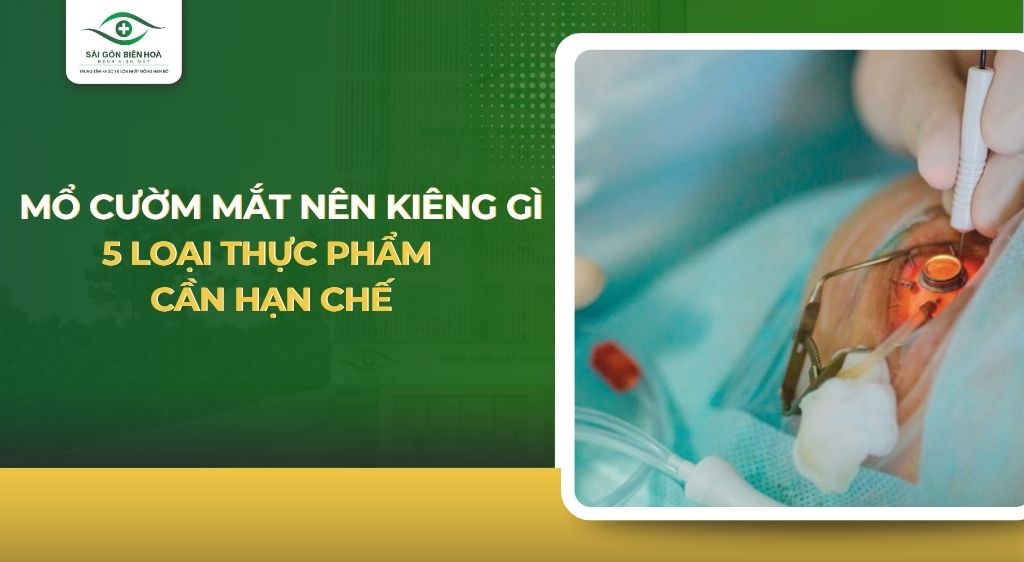 Mổ mắt cườm cần kiêng những gì? Gallery 1