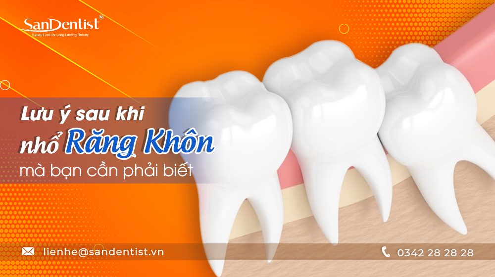 Nhổ răng khôn như thế nào? Gallery 2