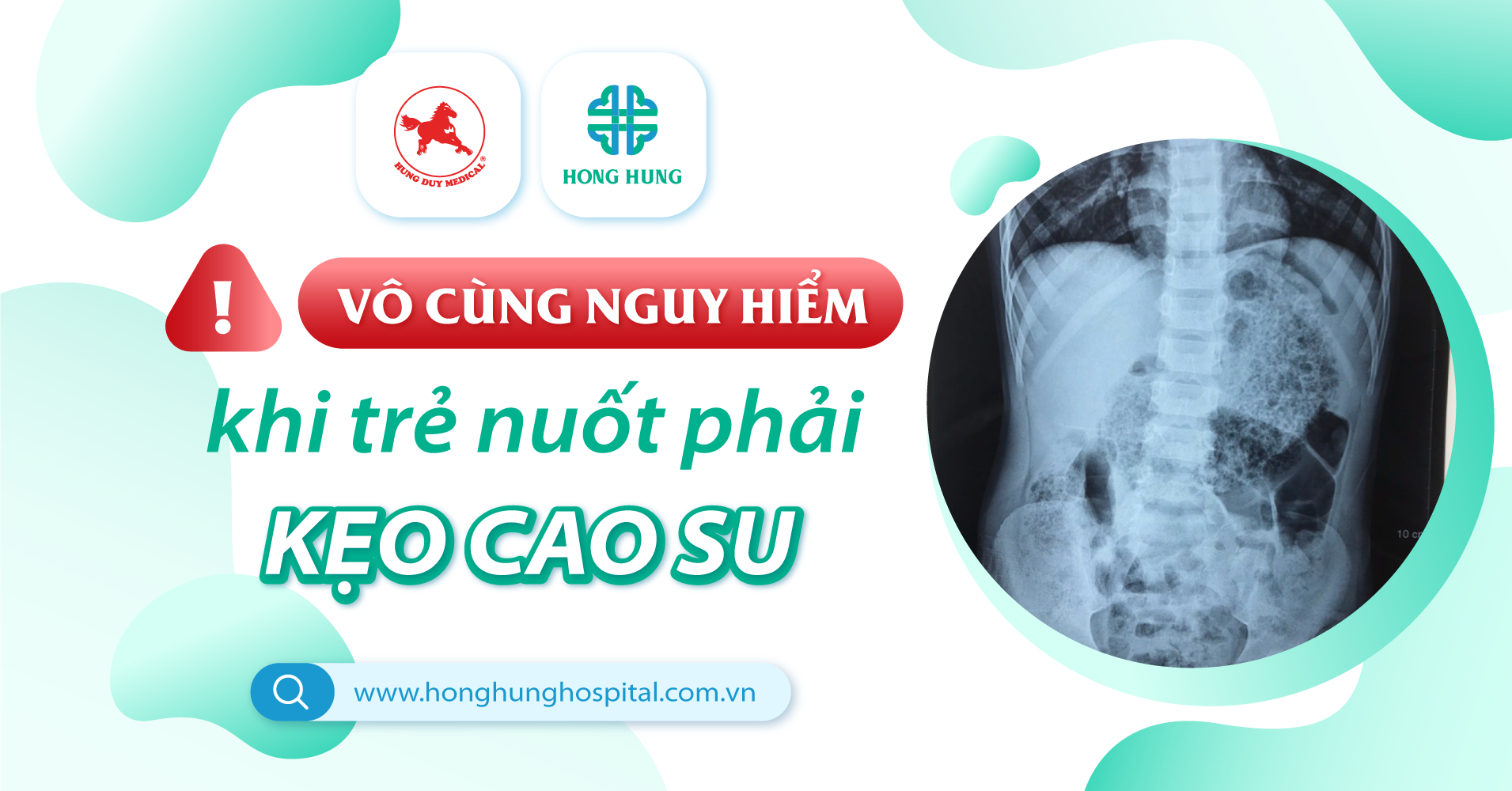Nuốt kẹo cao su có sao không? Gallery 2
