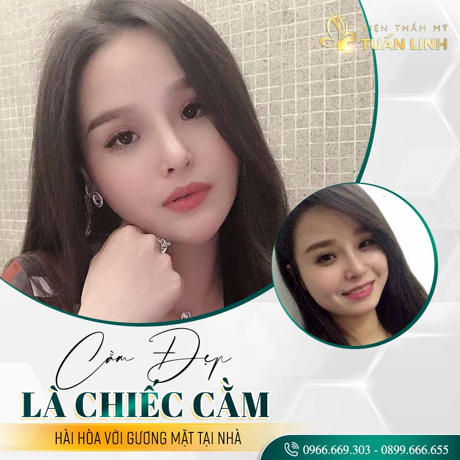 Cằm đầy đặn ở phụ nữ: Vẻ đẹp phúc hậu và quyến rũ Gallery 2