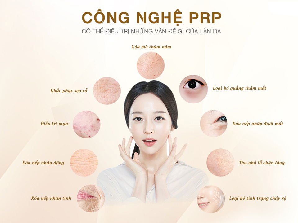 Cách Chăm Sóc Da Sau Khi Cấy Máu Tự Thân Hiệu Quả Gallery 1