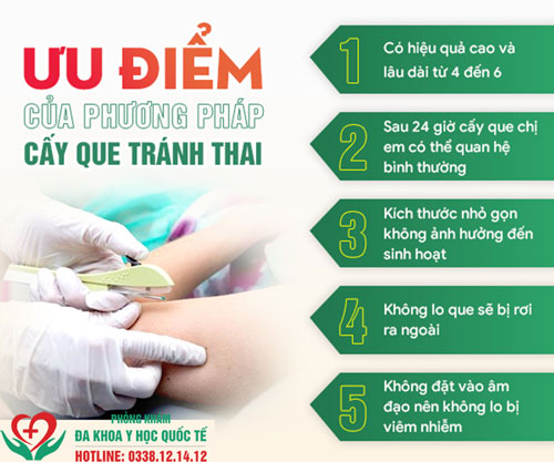Cấy que bao lâu thì quan hệ được? Gallery 2