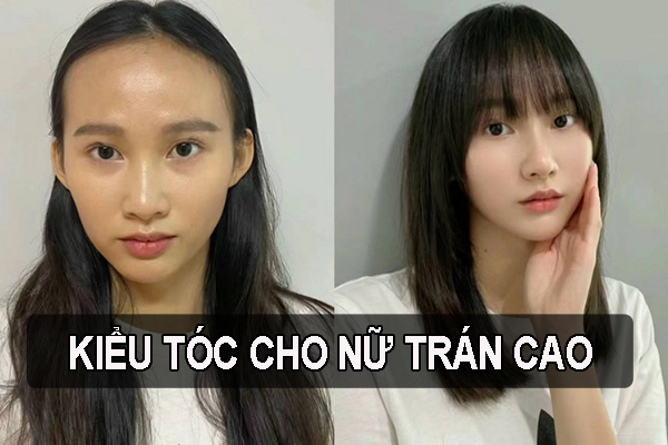 Trán dô nên để tóc gì? Gallery 1