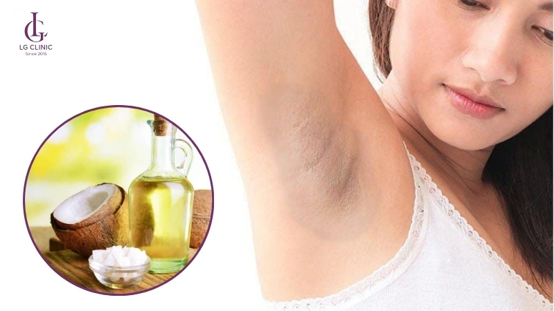 Dầu Dừa Trị Thâm Nách: Bí Quyết Làm Sáng Da Nách Hiệu Quả Gallery 2