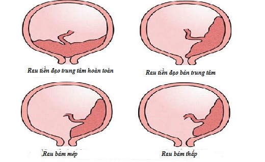 Rau bám thấp có nguy hiểm không? Gallery 2