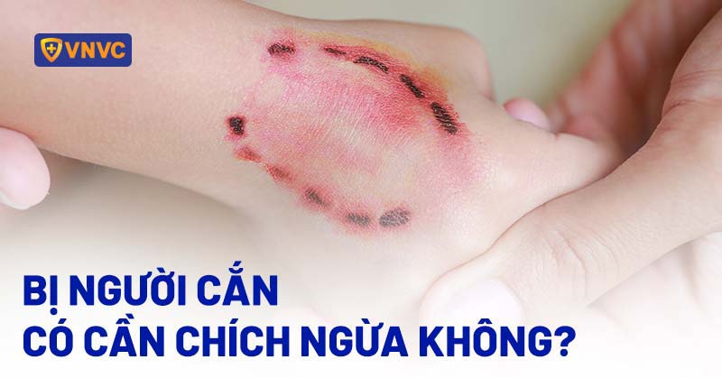 Chạy nọc là gì? Gallery 2