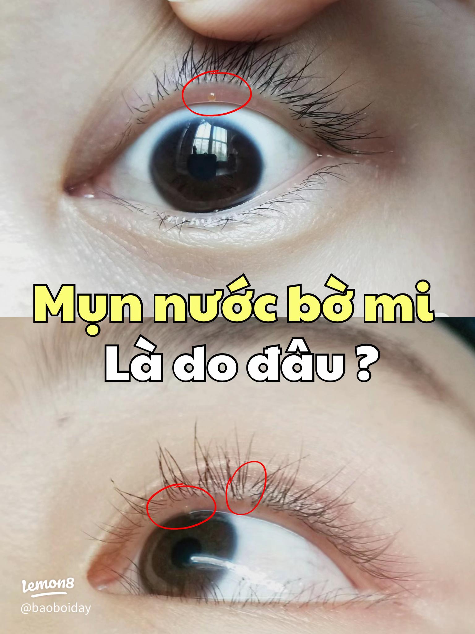 Vì Ai Đã Làm Ướt Bờ Mi Em? Gallery 1