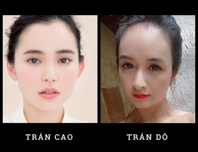 Con gái trán cao thì sao? Gallery 1
