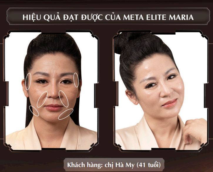 Phụ nữ trán vuông: Phong cách làm đẹp và những điều cần biết Gallery 2