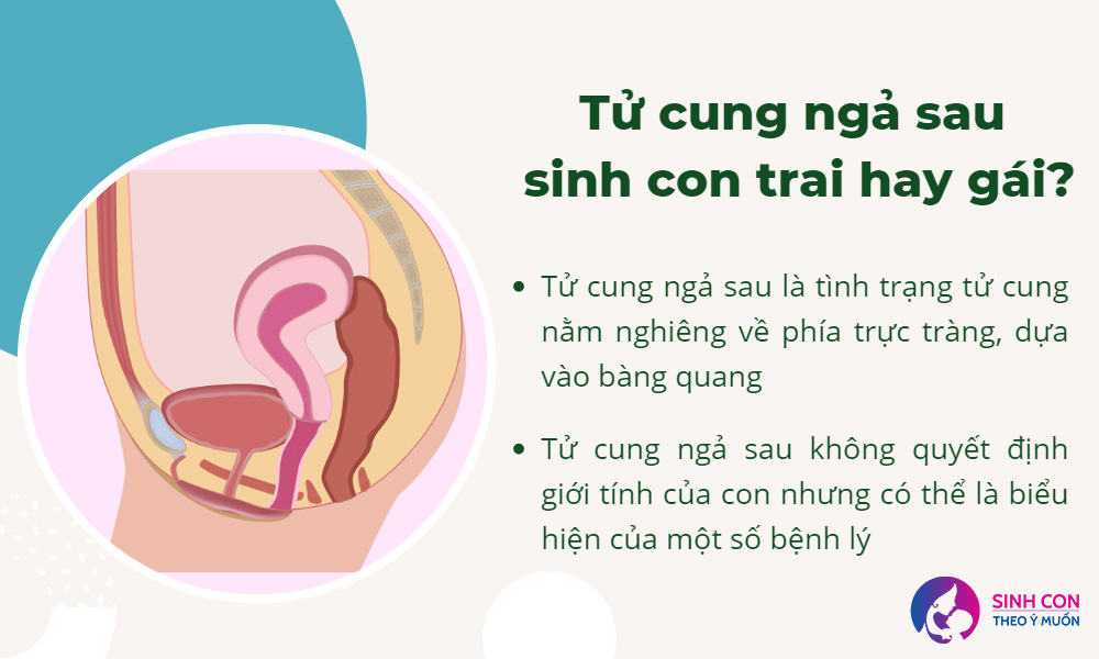 Tử cung ngả trước là con trai hay gái? Gallery 2