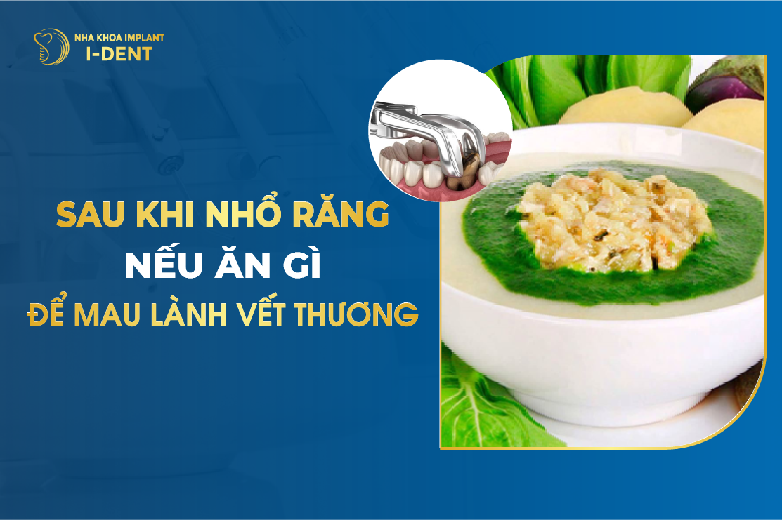 Mới nhổ răng nên ăn gì cho mau lành? Gallery 1