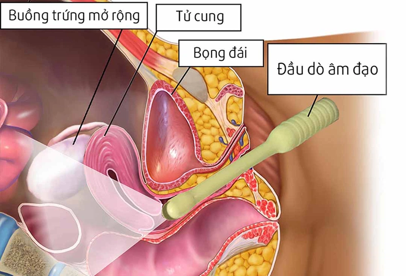 Thai bao nhiêu tuần thì không siêu âm đầu dò? Gallery 2