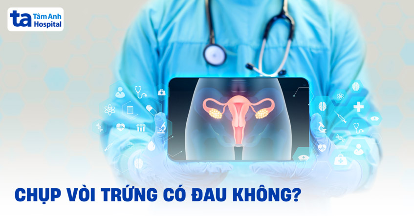 Chụp HSG có đau không? Gallery 2