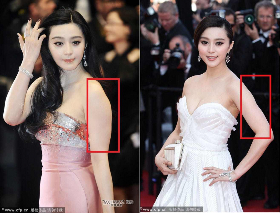 Thân hình mảnh mai là gì? Gallery 2