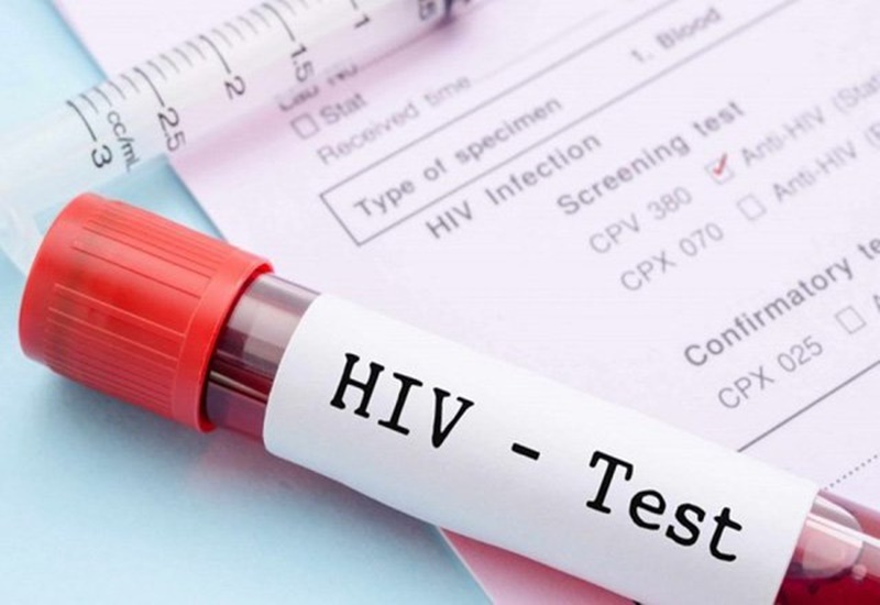 Xét nghiệm HIV bao lâu có kết quả? Gallery 2
