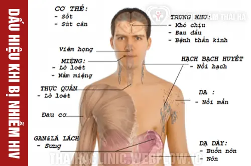 HIV Bao Lâu Thì Chết? Gallery 1