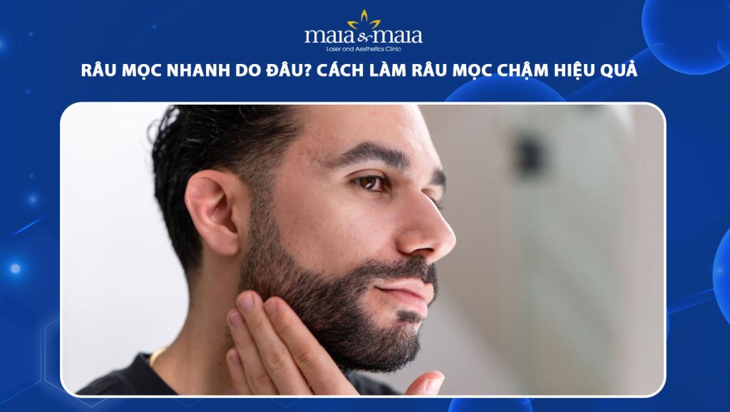 Râu mọc nhanh phải làm sao? Gallery 2