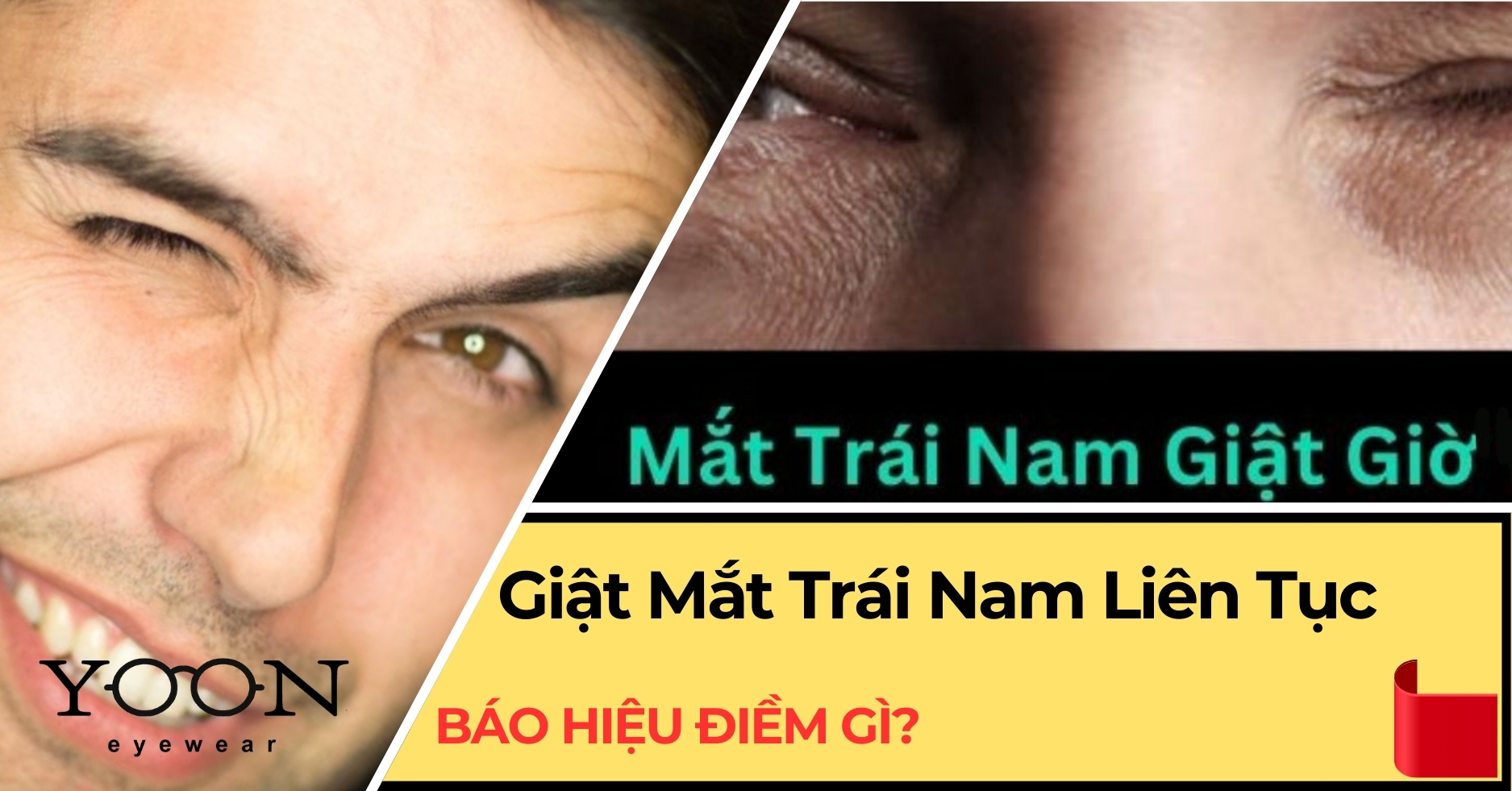 Mắt Trái Nam Giật Có Điềm Gì? Gallery 2