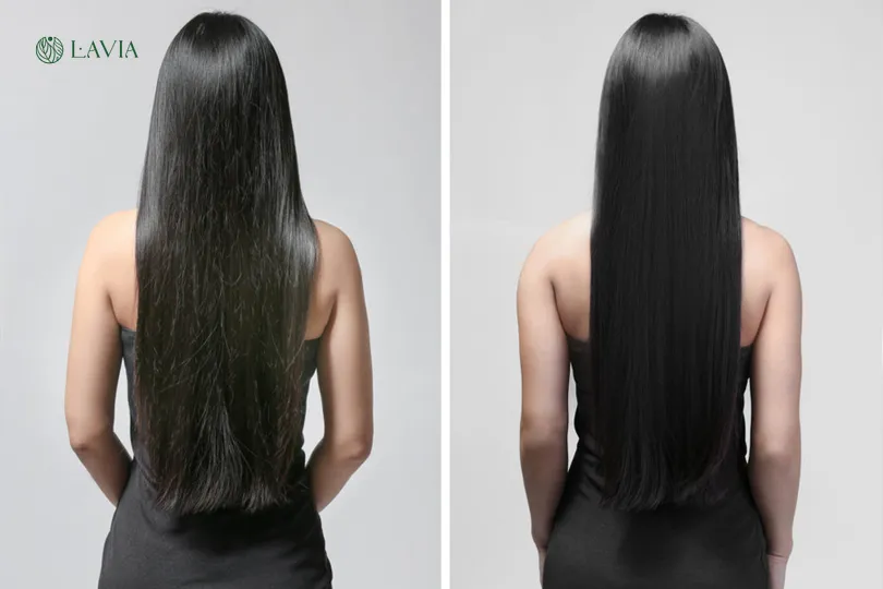 Duỗi Phồng Hơi Nước: Ưu điểm, Nhược điểm và Cách Sử Dụng Gallery 2