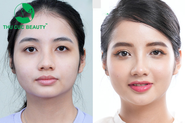 Nhấn Mí Thu Cúc: Phương Pháp Làm Đẹp Mắt An Toàn và Hiệu Quả Gallery 2