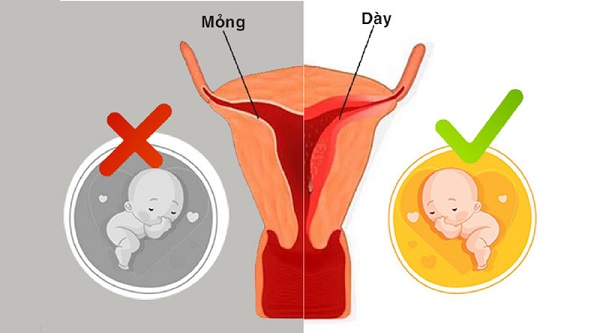 Niêm mạc mỏng là gì?