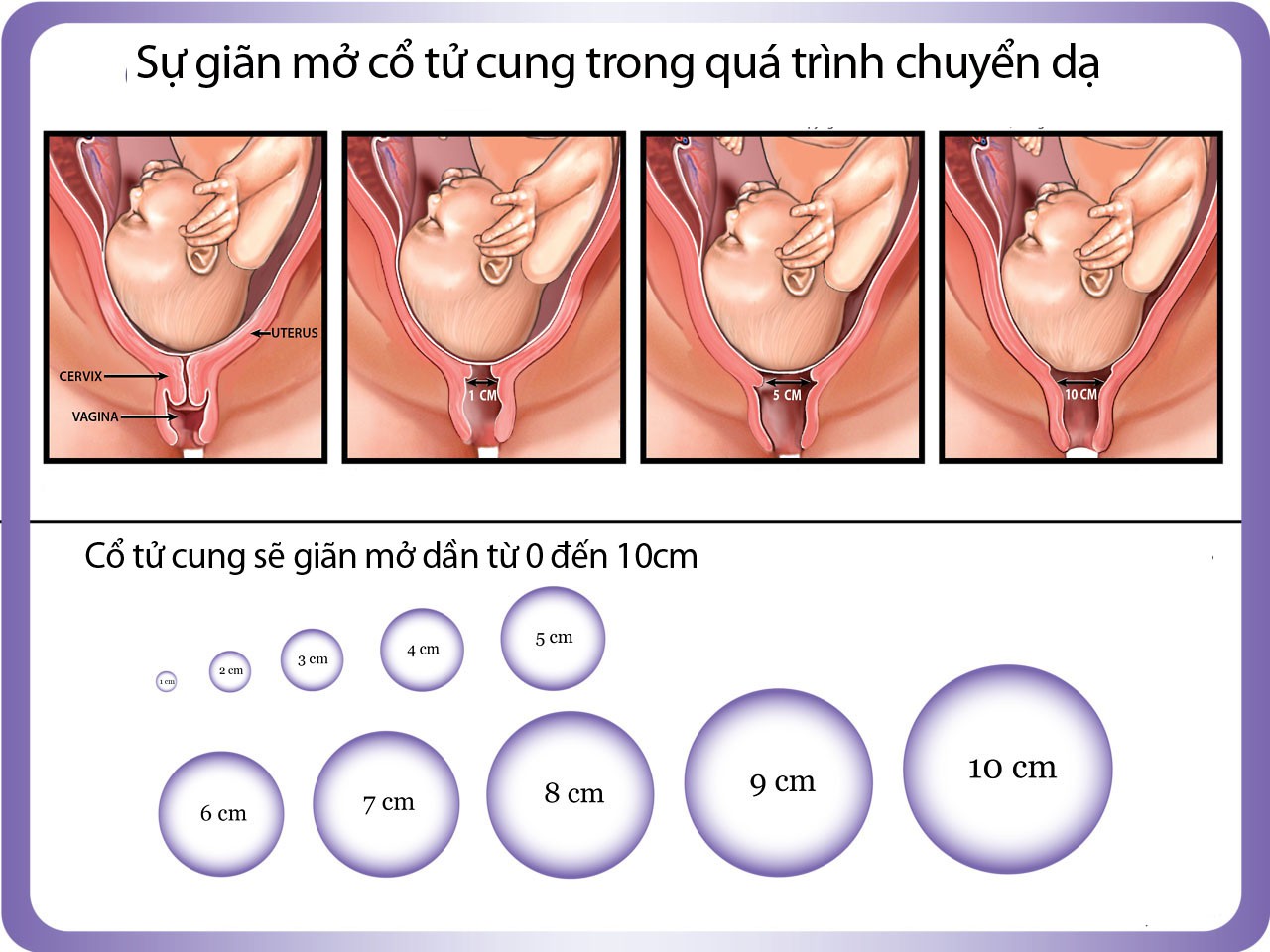 Nở 2 phân bao lâu thì sinh?